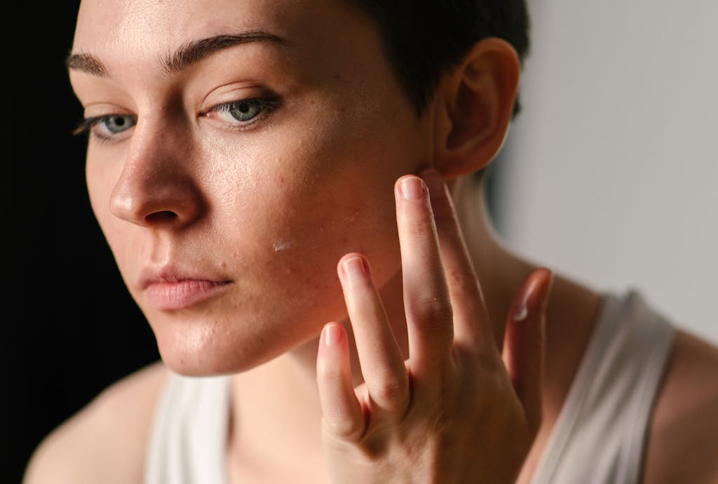 Kobieta z trądzikiem na twarzy przeglądająca się w lustrze
